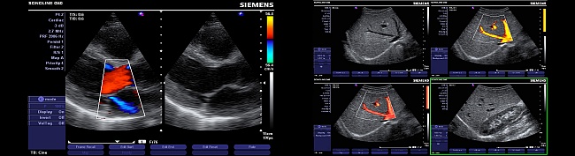 Sonographie